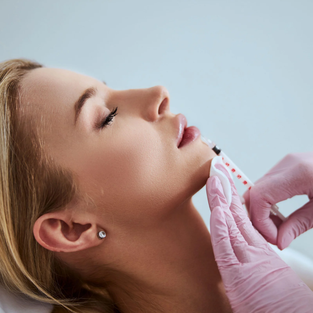 Dermal filler treatment