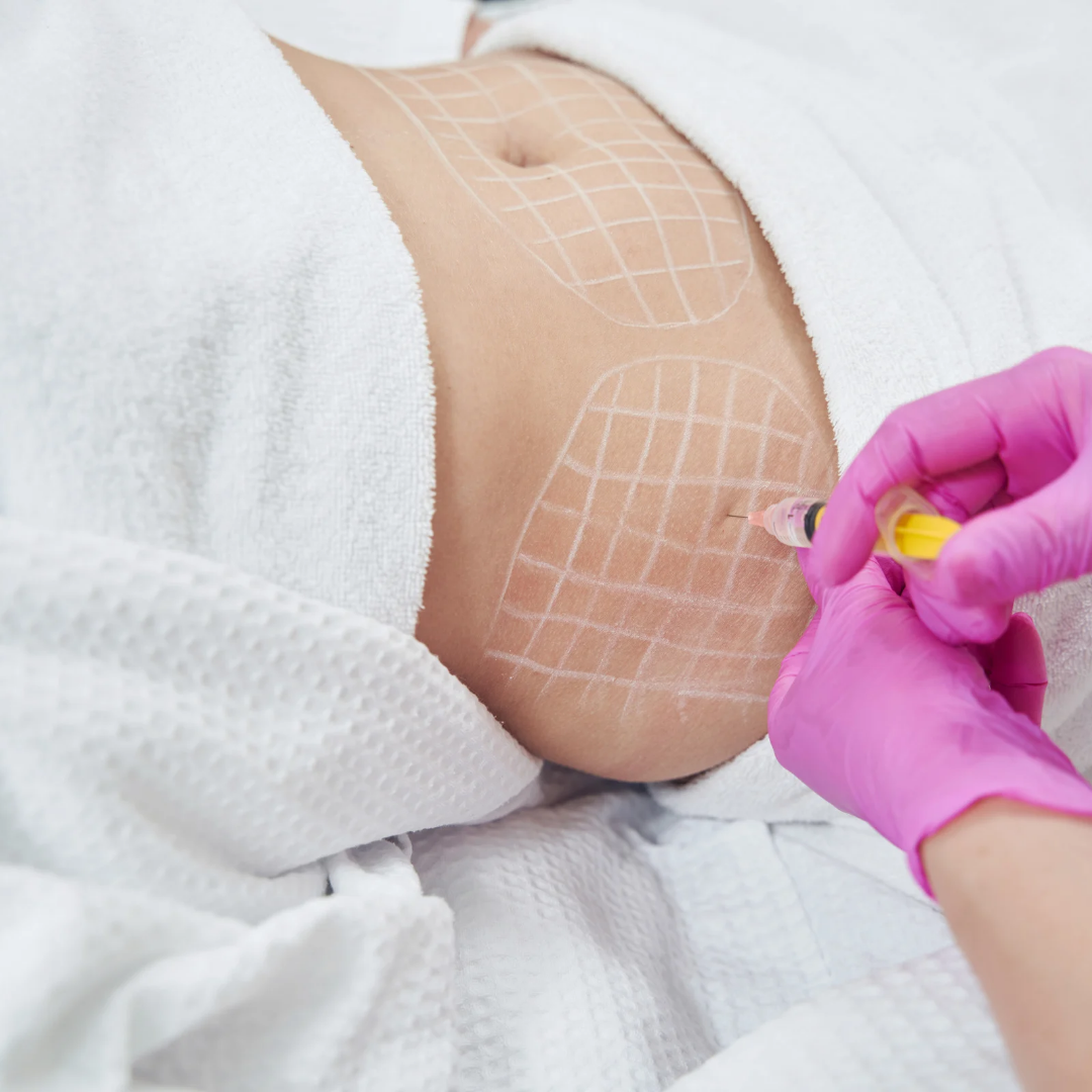 Fat dissolving injection