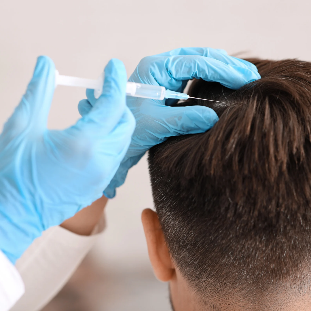 PRP treatment