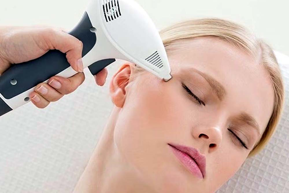 laser skin tightening treatment at genesis dermatology